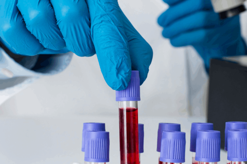 Hematology: Early Detection for Effective Blood Disease Treatment